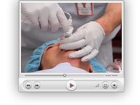 Difficult airway patient with the Ambu Aura-i Part 1